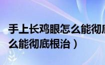 手上长鸡眼怎么能彻底根治掉（手上长鸡眼怎么能彻底根治）