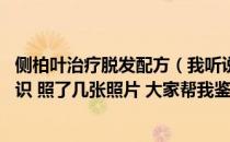 侧柏叶治疗脱发配方（我听说侧柏叶可以治脱发 但是我不认识 照了几张照片 大家帮我鉴别）